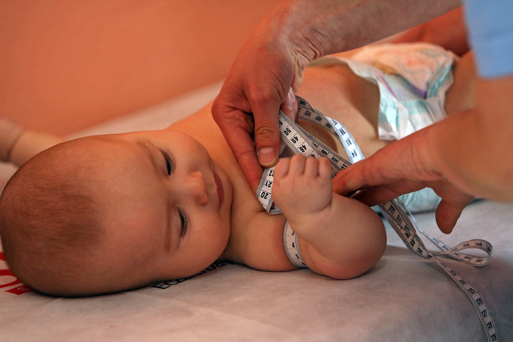 An infant gets measured as part of health check